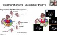 Echokardiographische Beurteilung der Mitralklappe zur Rekonstruktion