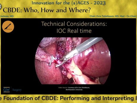 Grundlagen der CBDE – Durchführung und Interpretation der intraoperativen Cholangiographie (IOC)