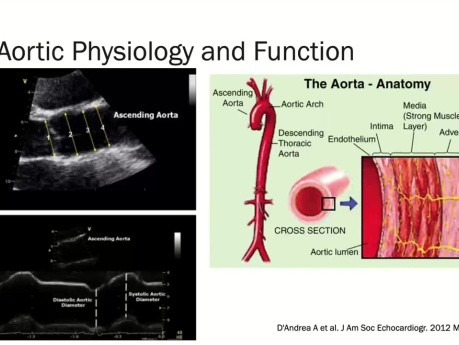 Echokardiographie für Aortenerkrankungen - Was Sie über die Aorta wissen sollten
