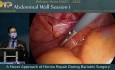 Ein neuartiger Ansatz der Hernienrekonstruktion während der bariatrischen Chirurgie