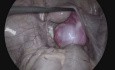 Grundlagen der laparoskopischen Anatomie