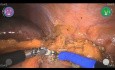 Partielle Nephrektomie links mit dem Versius-Roboter – Maurizio De Maria