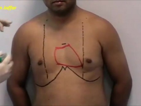 Brust - Anatomie