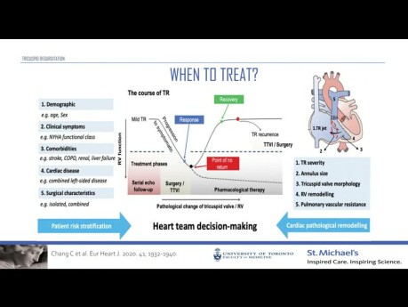 Bedeutung der Trikuspidalinsuffizienz bei Patienten mit Herzinsuffizienz