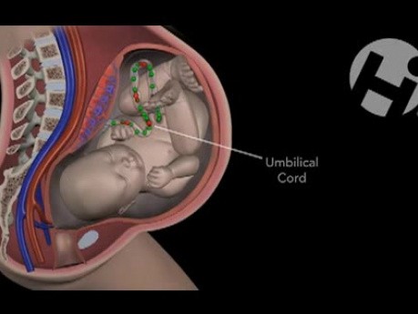 Kindslage und Amniotomie