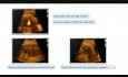 Restriktives Foramen Ovale in der Fetalperiode und im postnatalen Prozess