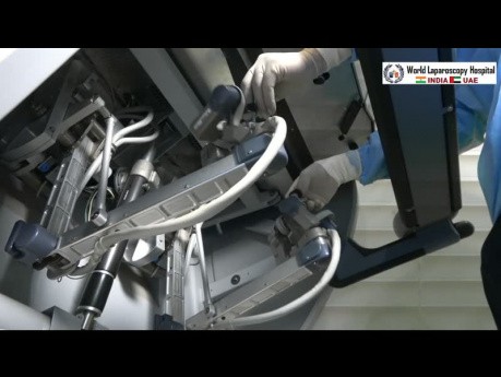 Robotisch-assistierte Hysterektomie- Da-Vinci-Operationssystem