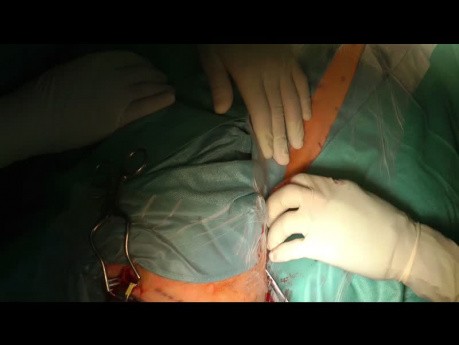 Normaldruckhydrozephalus
