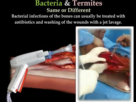 Termiten- und Bakterieninfektion - Videovortrag