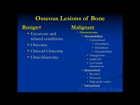 Kurs Orthopädische Onkologie - Gutartige knochenbildende Tumore (Osteoblastom, Osteoidosteom) - Vortrag 3