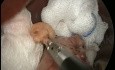 Hintere Cruroraphie mit 3 Schlüssellöchern und Schlauchmagen