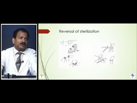 Laparoskopische Sterilisation