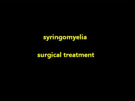 Syringomyelie – mikrochirurgische Behandlung