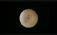 Essure-Sterilisation bei einer Patientin mit Hormonspirale Mirena