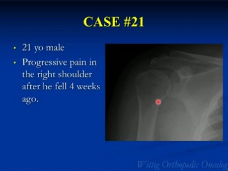 Kurs Orthopädische Onkologie - Unbekannte klinische Fälle - Teil C (Fälle 21-29) - Vortrag 13
