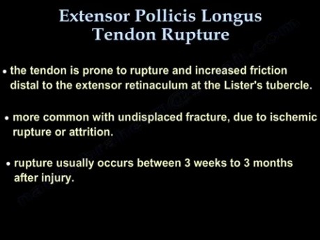 Ruptur der Sehne des M. extensor pollicis longus