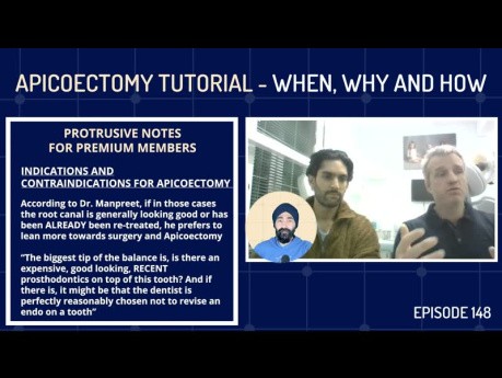 Tutorial zur Apikoektomie – Wann, Warum und Wie der apikalen Chirurgie – PDP148