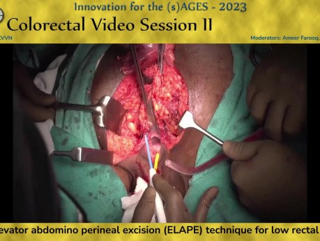 Extralevatorische abdominoperineale Exzision (ELAPE) bei tiefsitzendem Rektumkarzinom