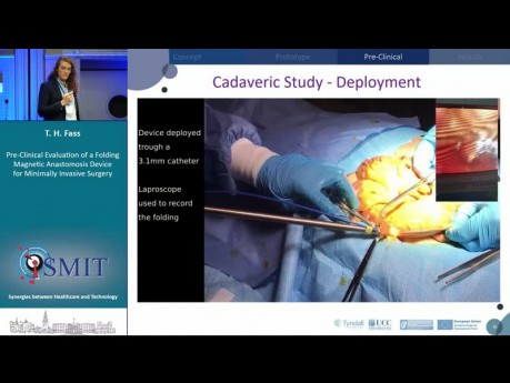 Konstruktion und präklinische Studie eines faltbaren magnetischen Anastomosegeräts für die minimalinvasive Chirurgie