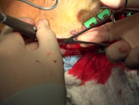 Chirurgische Therapie bei Frakturen des Schädeldaches, Os zygomaticum und Os mandibulare