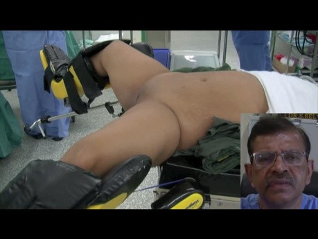 Tipps und Tricks bei der Durchführung laparoskopischer Operationen - Vorbereitung des Patienten auf die laparoskopische Operation