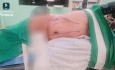 Laparoskopische rechtsseitige Adrenalektomie mit Lymphadenektomie bei 5 × 5 cm großer Nebennierenraumforderung