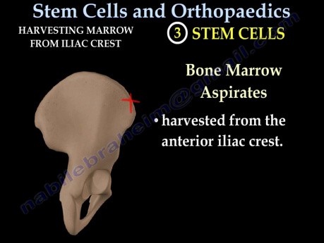 Stammzellen in der Orthopädie - Video-Vorlesung