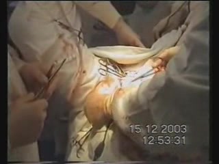 Enddarmkrebschirurgie