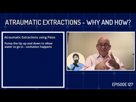 Atraumatische Extraktionen – wie und warum?