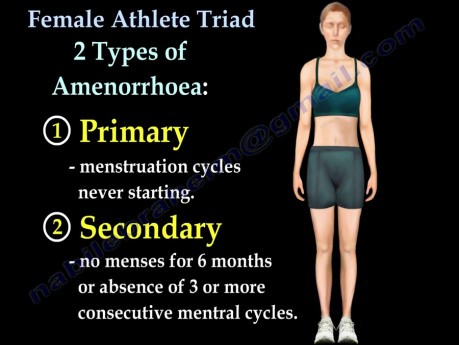 Triade der Sport treibenden Frau