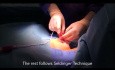 Vena subclavia - Port-A-Cath implantacjon