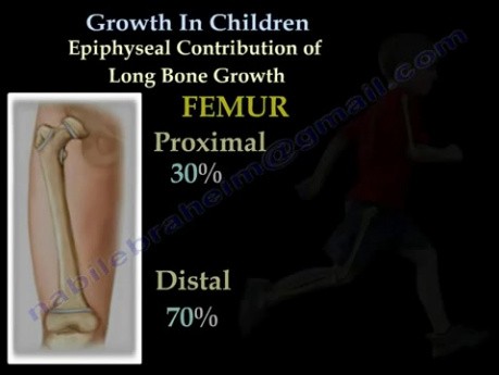 Knochenwachstum im Kinderalter